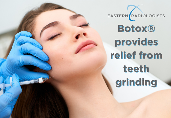 Botox - Teeth Grinding_April 2025