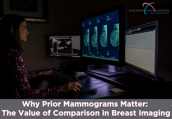 Why Prior Mammograms Matter