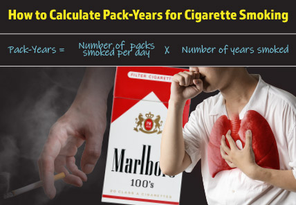 How to Calculate Pack-Years for Cigarette Smoking